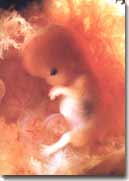 Dezvoltarea embrionara saptamana a 10-a