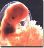 Dezvoltarea embrionara saptamana a 11-a