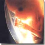 Dezvoltarea embrionara saptamana a 12-a